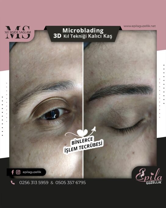 Nazilli - Microblading 3D Kıl Tekniği Kalıcı Kaş Kontürü