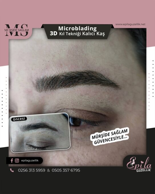 Nazilli - Microblading 3D Kıl Tekniği Kalıcı Kaş Kontürü