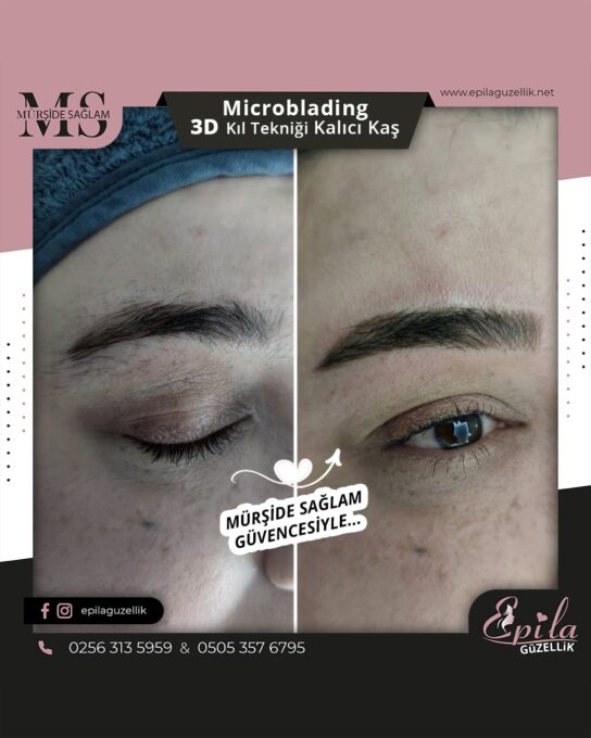 Nazilli - Microblading 3D Kıl Tekniği Kalıcı Kaş Kontürü