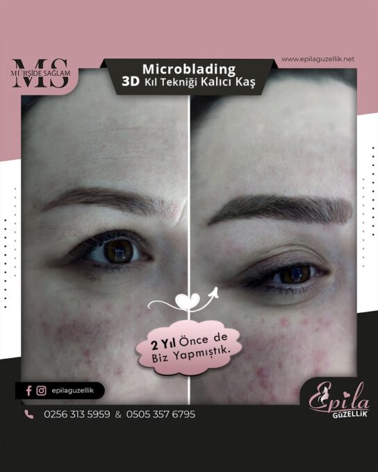 Nazilli - Microblading 3D Kıl Tekniği Kalıcı Kaş Kontürü