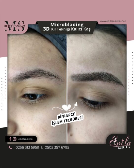 Nazilli - Microblading 3D Kıl Tekniği Kalıcı Kaş Kontürü