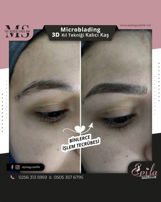 Nazilli - Microblading 3D Kıl Tekniği Kalıcı Kaş Kontürü