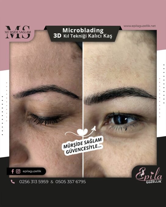 Nazilli - Microblading 3D Kıl Tekniği Kalıcı Kaş Kontürü