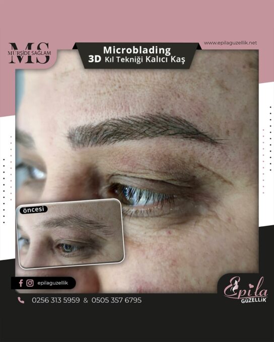 Nazilli - Microblading 3D Kıl Tekniği Kalıcı Kaş Kontürü