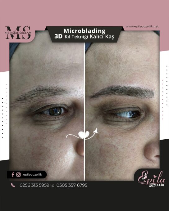 Nazilli - Microblading 3D Kıl Tekniği Kalıcı Kaş Kontürü