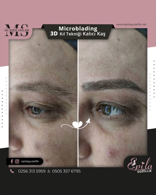 Nazilli - Microblading 3D Kıl Tekniği Kalıcı Kaş Kontürü