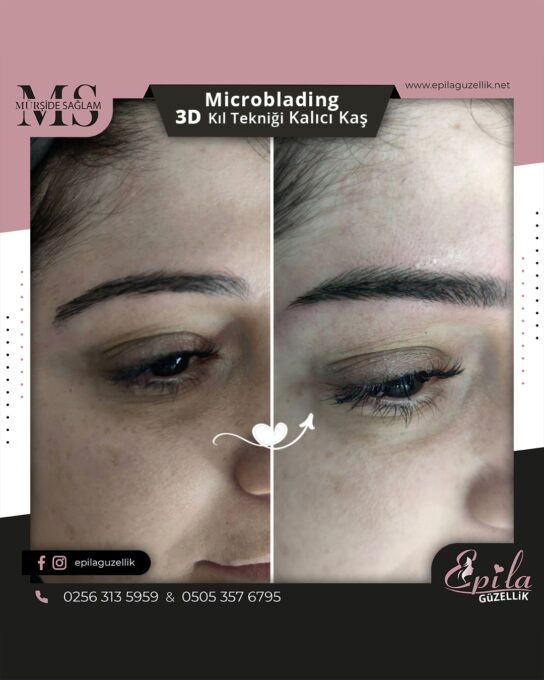 Nazilli - Microblading 3D Kıl Tekniği Kalıcı Kaş Kontürü