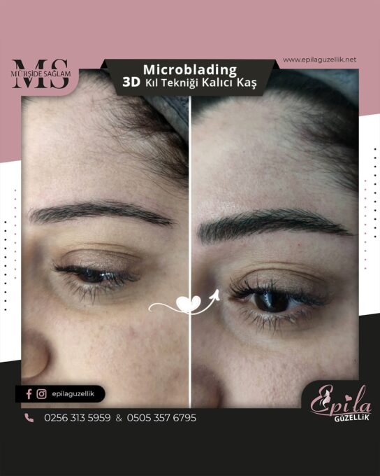 Nazilli - Microblading 3D Kıl Tekniği Kalıcı Kaş Kontürü