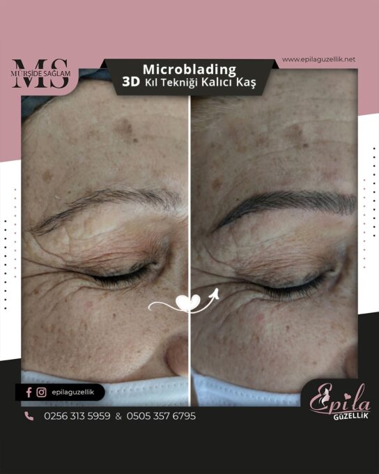 Nazilli - Microblading 3D Kıl Tekniği Kalıcı Kaş Kontürü