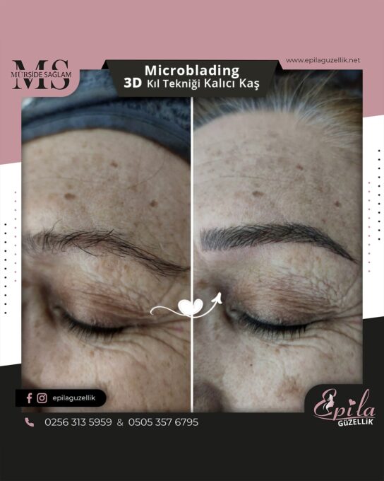 Nazilli - Microblading 3D Kıl Tekniği Kalıcı Kaş Kontürü