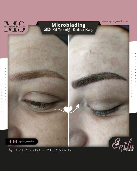 Nazilli - Microblading 3D Kıl Tekniği Kalıcı Kaş Kontürü