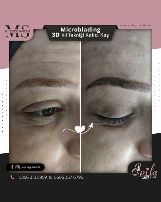 Nazilli - Microblading 3D Kıl Tekniği Kalıcı Kaş Kontürü