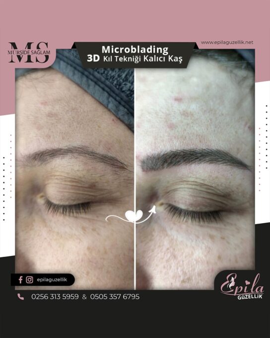 Nazilli - Microblading 3D Kıl Tekniği Kalıcı Kaş Kontürü