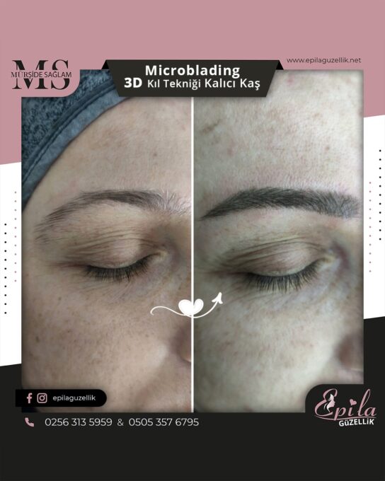 Nazilli - Microblading 3D Kıl Tekniği Kalıcı Kaş Kontürü