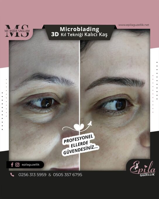 Nazilli - Microblading 3D Kıl Tekniği Kalıcı Kaş Kontürü