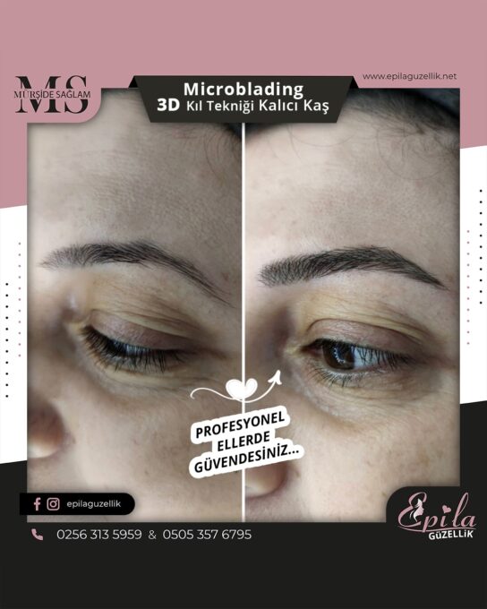 Nazilli - Microblading 3D Kıl Tekniği Kalıcı Kaş Kontürü