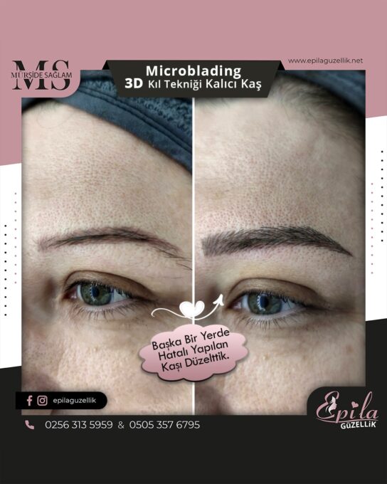 Nazilli - Microblading 3D Kıl Tekniği Kalıcı Kaş Kontürü