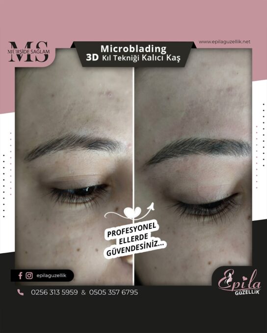 Nazilli - Microblading 3D Kıl Tekniği Kalıcı Kaş Kontürü