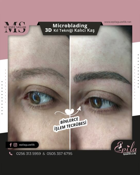 Nazilli - Microblading 3D Kıl Tekniği Kalıcı Kaş Kontürü