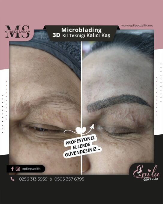 Nazilli - Microblading 3D Kıl Tekniği Kalıcı Kaş Kontürü