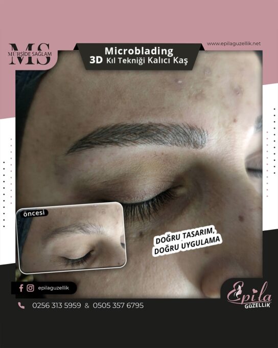 Nazilli - Microblading 3D Kıl Tekniği Kalıcı Kaş Kontürü