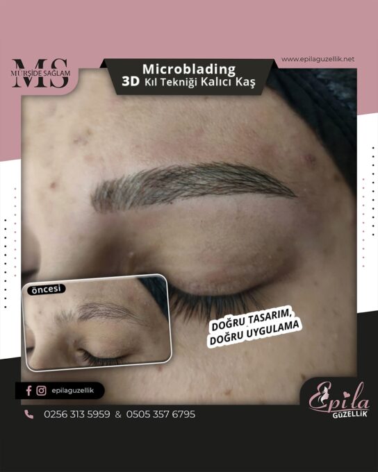 Nazilli - Microblading 3D Kıl Tekniği Kalıcı Kaş Kontürü