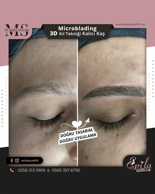 Nazilli - Microblading 3D Kıl Tekniği Kalıcı Kaş Kontürü