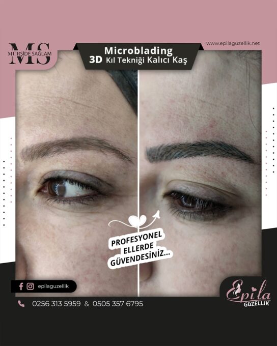 Nazilli - Microblading 3D Kıl Tekniği Kalıcı Kaş Kontürü