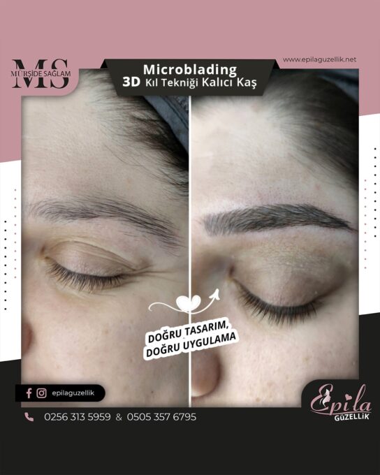 Nazilli - Microblading 3D Kıl Tekniği Kalıcı Kaş Kontürü