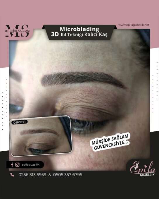 Nazilli - Microblading 3D Kıl Tekniği Kalıcı Kaş Kontürü