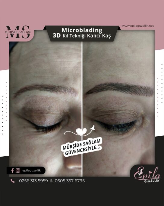 Nazilli - Microblading 3D Kıl Tekniği Kalıcı Kaş Kontürü