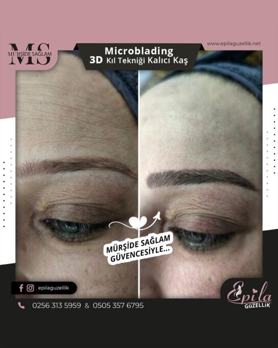 Nazilli - Microblading 3D Kıl Tekniği Kalıcı Kaş Kontürü