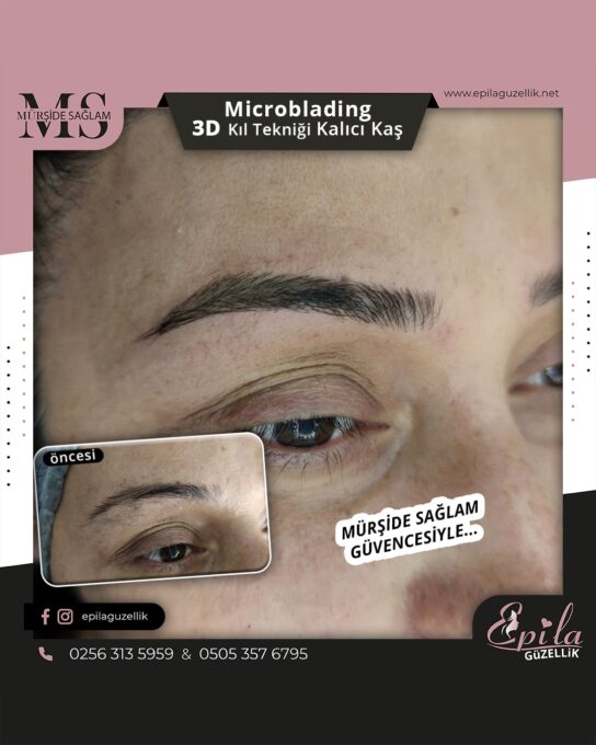 Nazilli - Microblading 3D Kıl Tekniği Kalıcı Kaş Kontürü