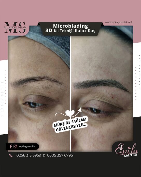 Nazilli - Microblading 3D Kıl Tekniği Kalıcı Kaş Kontürü