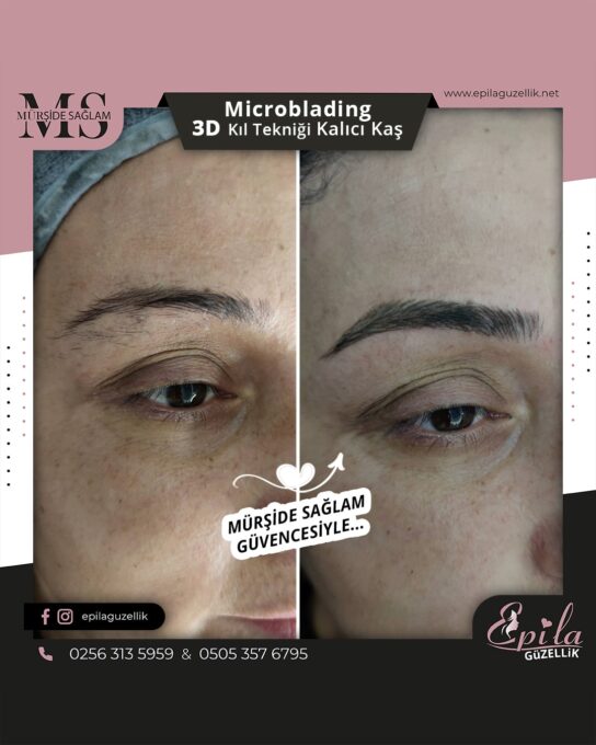 Nazilli - Microblading 3D Kıl Tekniği Kalıcı Kaş Kontürü