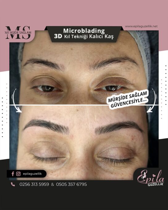 Nazilli - Microblading 3D Kıl Tekniği Kalıcı Kaş Kontürü