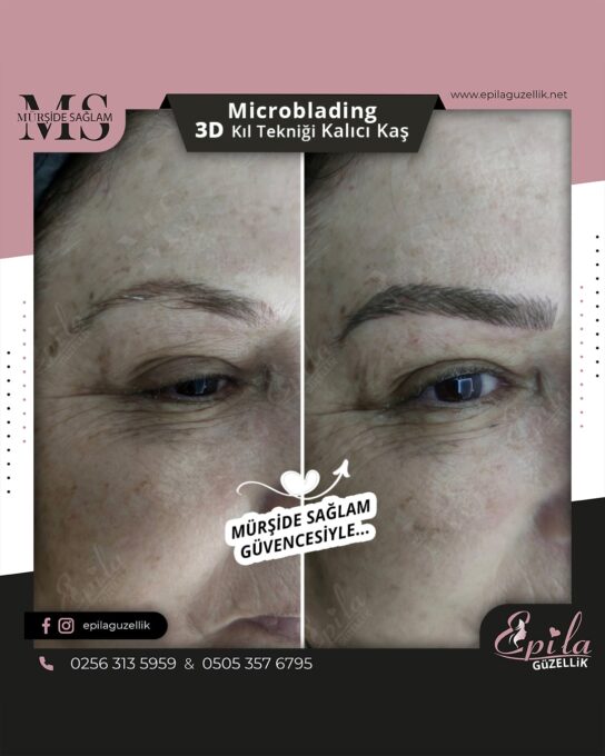 Nazilli - Microblading 3D Kıl Tekniği Kalıcı Kaş Kontürü