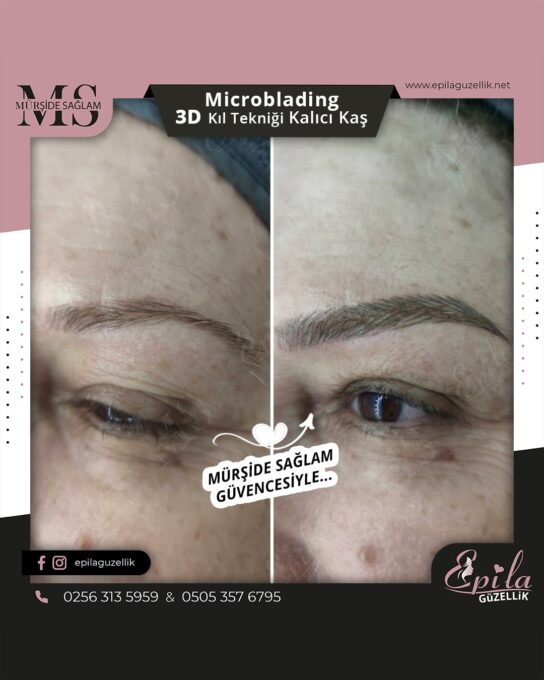 Nazilli - Microblading 3D Kıl Tekniği Kalıcı Kaş Kontürü