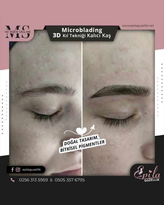 Nazilli - Microblading 3D Kıl Tekniği Kalıcı Kaş Kontürü