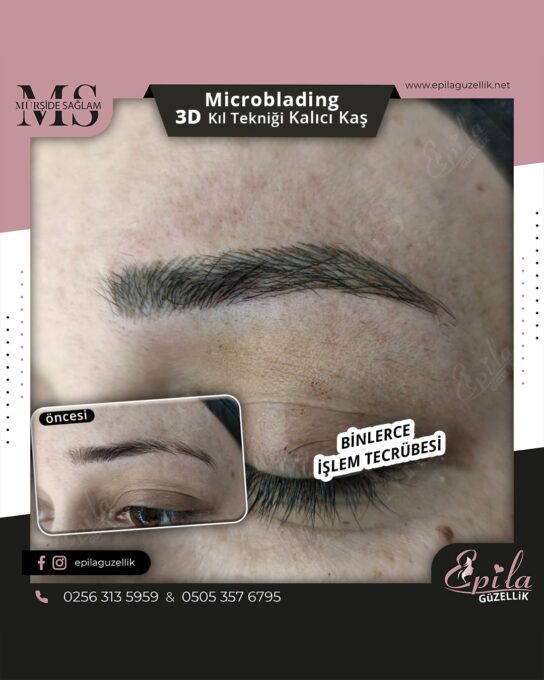 Nazilli - Microblading 3D Kıl Tekniği Kalıcı Kaş Kontürü