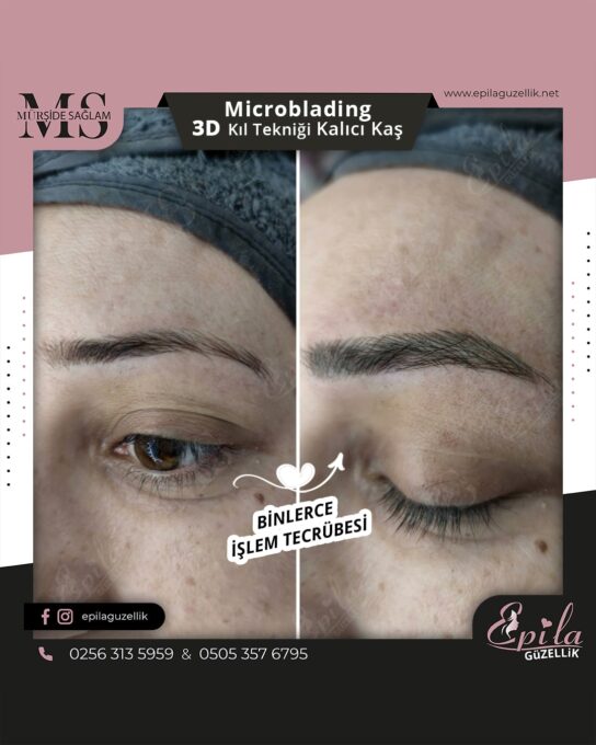 Nazilli - Microblading 3D Kıl Tekniği Kalıcı Kaş Kontürü