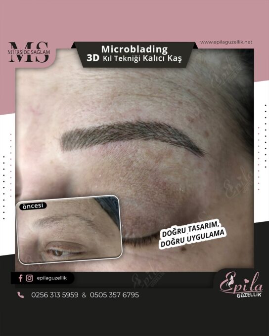 Nazilli - Microblading 3D Kıl Tekniği Kalıcı Kaş Kontürü