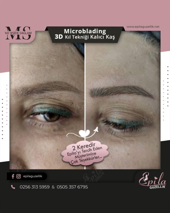 Nazilli - Microblading 3D Kıl Tekniği Kalıcı Kaş Kontürü