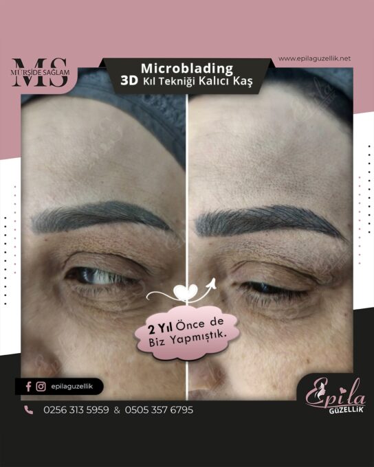 Nazilli - Microblading 3D Kıl Tekniği Kalıcı Kaş Kontürü