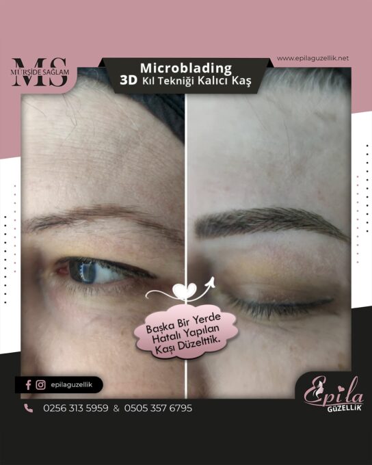 Nazilli - Microblading 3D Kıl Tekniği Kalıcı Kaş Kontürü