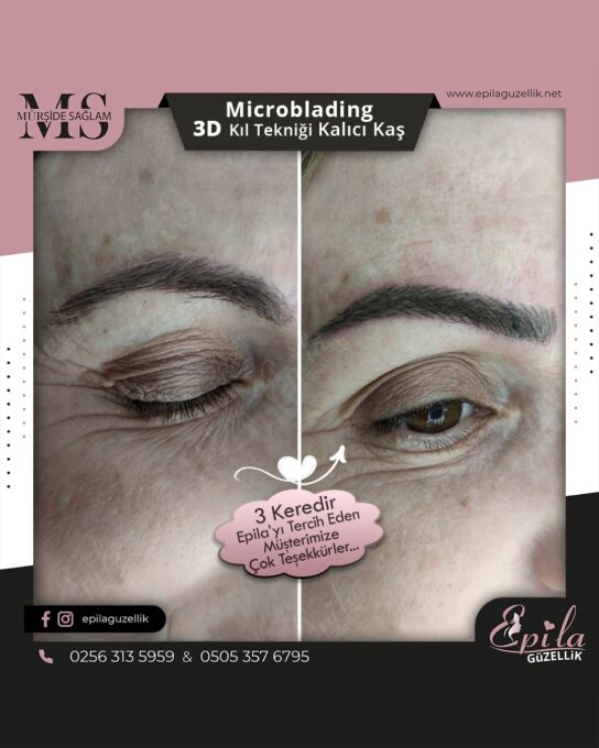 Nazilli - Microblading 3D Kıl Tekniği Kalıcı Kaş Kontürü