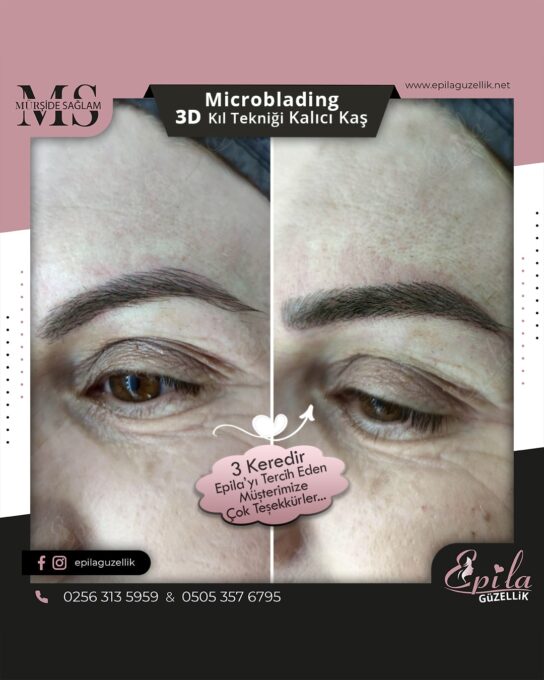 Nazilli - Microblading 3D Kıl Tekniği Kalıcı Kaş Kontürü