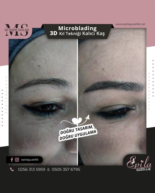 Nazilli - Microblading 3D Kıl Tekniği Kalıcı Kaş Kontürü