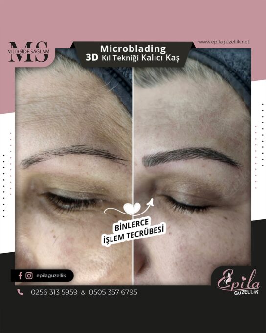 Nazilli - Microblading 3D Kıl Tekniği Kalıcı Kaş Kontürü