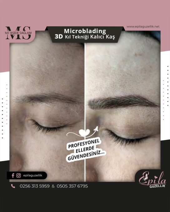 Nazilli - Microblading 3D Kıl Tekniği Kalıcı Kaş Kontürü